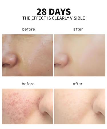 4-in-1 Premium Facial Serum | Vitamin C Hyaluronic Acid Niacinamide Vitamin E for Dark Spots Anti-Aging & Hydration - 1oz - Buy Online on GoSupps.com