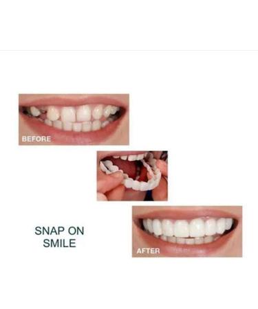 Xiaocui Instant Veneers Teeth - Comfortable Upper & Lower Dentures for a Perfect Smile | 2-Piece Set - Buy Online on GoSupps.com