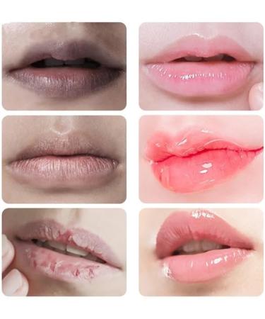 JINSHANE Lip Serum JINSHANE Dark Lip Treatment JINSHANE Korean Lip Serum JINSHANE Lip Lightening Moisturizing Nourishing Essence (2) - Buy Online on GoSupps.com