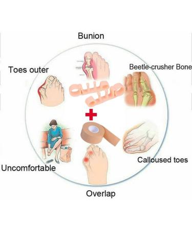 Reusable Multi Toe Alignment Corrector & Bunion Protector | Foot Yoga Stretchers + Heel Sticker Tape - International Shipping - Buy Online on GoSupps.com