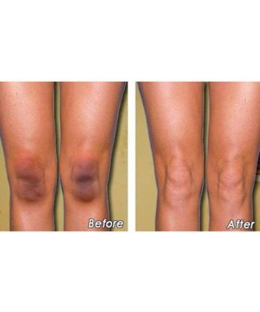 Woya Whitening Essential Oil for Face Remove Dark Spots Brightening Whitening Anti-Aging Nourishing Essence (1PC) - Buy Online on GoSupps.com