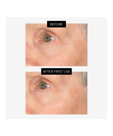 Perlier Black Rice Eye Serum Anti-Aging Moisturizing Gel Fine Line Reducer With Organic Black Rice Extract Light Texture Formula 2-Pack1.5 fl oz each - Buy Online on GoSupps.com