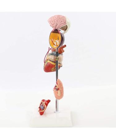 Diabetic Heart Kidney Organ Model PVC Diabetes Pathology Model 5 Removable Parts Eyeball Hear Kidney Vessel Foot Thrombosis Diabetic Fundus School Education Learning Collectibles - Buy Online on GoSupps.com