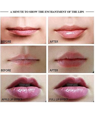 Buy Lip Plumping Tool | Soft Silicone Lip Enhancer & Device | Electric Lip Beauty Instrument with 3 Modes International Shipping Available - Buy Online on GoSupps.com