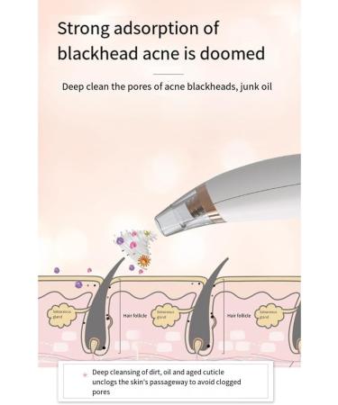 Sgnsvj Electric Blackhead Remover Face Pimple Extraction Deep Spots Pore Acne Removal Cleaner Cleanser - Buy Online on GoSupps.com