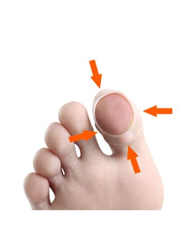 Supvox Toe Nail Correction Patch - 3 Pairs Gel Smoothing Stickers for Pedicure & Protection - Effective Nail Treatment for Adults & Students - Buy Online on GoSupps.com