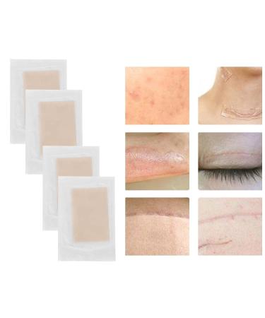 SILICONE SCAR SHEETS | Professional Gel Patch for Scar Removal, Stretch Marks, Keloids | C-Section & Stomach Pads for Men & Women - Skin Care Stickers - Buy Online on GoSupps.com