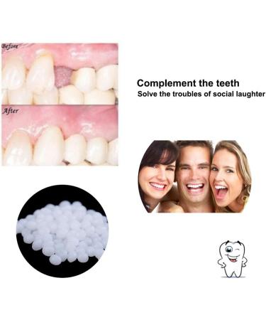 SowSmile 20g Temporary False Teeth Repair Beads - Light Yellow | Moldable Thermal Fitting for Instant Confident Smile - Buy Online on GoSupps.com