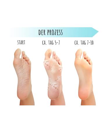 Premium Summer Foot Mask Socks - 2 Pairs of Dermatologically Tested Cornea Foot Care Masks for Soft Feet - Buy Online on GoSupps.com
