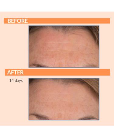 Serious Skincare Serious-C3 Plasma Vitamin C Day Trio | C Cream SPF 30 Vitamin C Serum & C-Eye Treatment for Radiant Skin - Buy Online on GoSupps.com