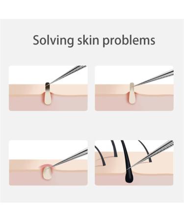 Usiveinborn Blackhead Remover Blackhead Tweezers Facial Blackhead Remover Tweezers Professional Stainless Steel Facial Blackhead Remover Tweezers (8-Piece Set) - Buy Online on GoSupps.com