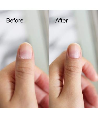 KOZEAR Cuticle Nipper - Surgical Stainless Steel Dead Skin Trimmer and Manicure Tool - Buy Online on GoSupps.com