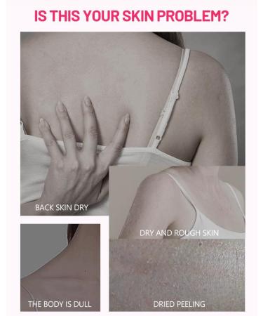 Underarm Whitening Cream Nicotinamide Whitening Cream Armpit Whitening Cream for All Skin Type - Buy Online on GoSupps.com