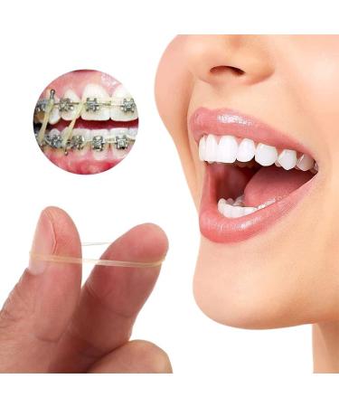300PC Orthodontic Rubber Bands & Bracelets - Elastic Dental Tools for Teeth Alignment | International Shipping - Buy Online on GoSupps.com