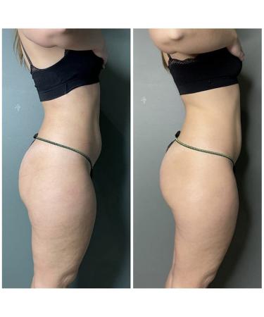 GUAM Seaweed Mud Body Wrap 1KG + Anti-cellulite Gel 250ml Set - Cellulite Remover & Treatment Kit - Buy Online on GoSupps.com