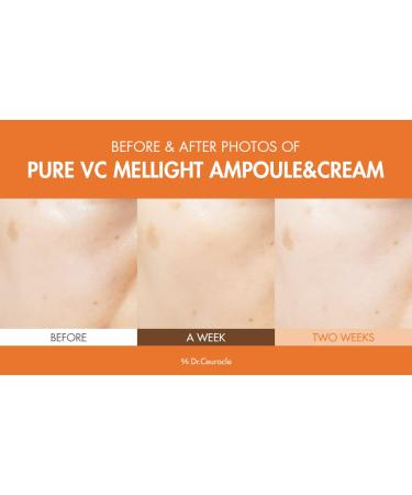 Dr.Ceuracle by leegeehaam Pure VC Mellight Ampoule - Vitamin C Serum for Face, One Week Program for Anti-oxidant, Firm, Clarify, Fade Pigmentation, Skin Radiance (1 Count (Pack of 1)) - Buy Online on GoSupps.com