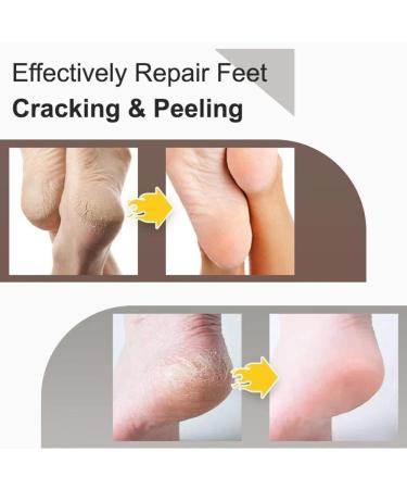 SURORAIN Advanced Foot Repair Cream - Moisturizing Hand & Body Moisturizer for Dry Cracked Heels, Callus Remover - 0.53 oz - Buy Online on GoSupps.com