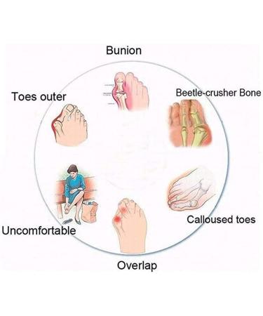 BestWalk Bunion Sandals | Orthopedic Premium Toe Corrector | Black 8.5-9 Size - Buy Online on GoSupps.com