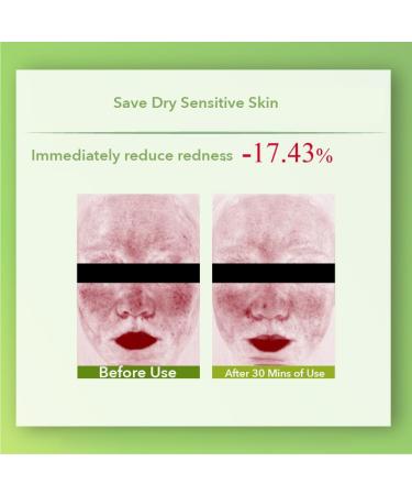 1PC John Jeff Olive Soothing Special Care Oil Serum Relieving Redness Balancing Moisturizing Facial Essence Strengthen Skin Oil Ampoule (Dry Skin 30ml) - Buy Online on GoSupps.com