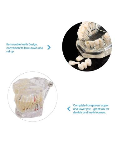 Buy Youya Transparent Dental Tooth Model for Dentists | Removable Pathological Teaching Model | International Shipping Available - Buy Online on GoSupps.com