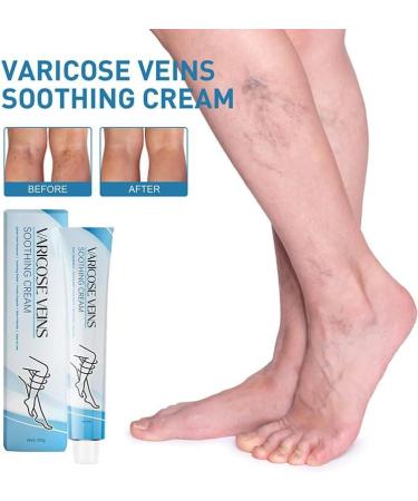 GeRRiT Organic Varicose Vein Treatment Cream Varicose Vein Treatment Varicose Vein Treatment on Legs Reduces Spider Veins and Heaviness - Buy Online on GoSupps.com