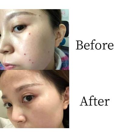 SIPORY Herbal Skin Cleanup Ointment - Huangfutang Concentrated Removal Cream (3pc) - Buy Online on GoSupps.com