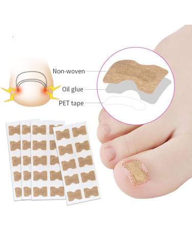 CheeseandU 2022 Ingrown Toenail Stickers 10-Pack - Glue-Free Toe Nail Patch for Painless Correction - Men & Women Toenail Care - Buy Online on GoSupps.com