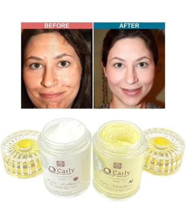  OBBBeaut O'Carly Day and Night Face Cream with Kojic Acid Glutathione and Collagen - Extra Whitening and Brightening for Skin (2 x 80g) - Buy Online on GoSupps.com