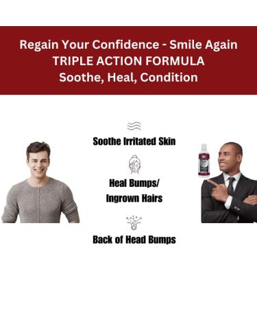 Extra Strength Alcohol-Free Bump Terminator - Anti Bump & Ingrown Hair Treatment Serum 4 oz | Razor Bump Remover - Buy Online on GoSupps.com
