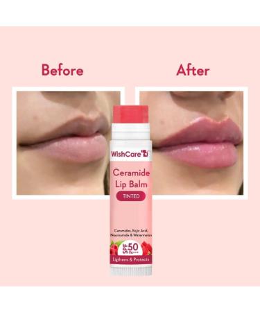 Buy Tinted Ceramide Lip Balm SPF50 PA+++ | Kojic Acid & Niacinamide for Lip Lightening & Protection - 5gm Worldwide Shipping - Buy Online on GoSupps.com