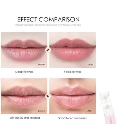 Lip Boost Derma Roller with Serum Holder for Microneedling 0.5mm Derma Roller Lip Plumper 105 Titanium Pins Designed Specifically for Lips Micro Infusion System - Buy Online on GoSupps.com
