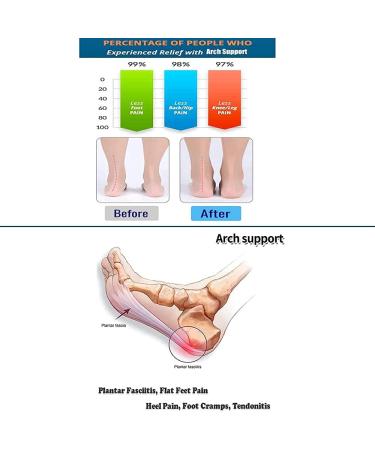 Doctor Developed Arch Support Sleeves 2.0 - Small/Medium Size M 8.5-12/W 9.5-13 - Flat Feet Relief - Reusable Inserts for Orthopedic Shoes - Midfoot Pain Relief - 1 Pair - Buy Online on GoSupps.com