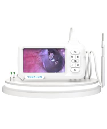 YUNCHUN Screen Endoscope is an Observation Magnifier with 1 million Pixel 3.9mm Camera 4.3-inch IPS Screen Visual Ear Cleaner Ear Wax Removal Digital Otoscope 1920*1080P 2600mAh Rechargeable Battery