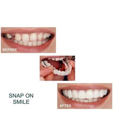 6pcs Artificial Braces - White Smile Clip-in Veneers for Upper & Lower Teeth | Temporary Solution for Perfect Smiles - Buy Online on GoSupps.com