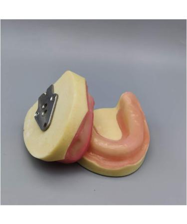 Fhuili Dental Implant Practice Model - Gum-Free Distental Model for Advanced Training - Buy Online on GoSupps.com