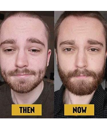 The Beard Club Beard Growth Oil - Promote Healthy Full Beard Growth - Buy Online on GoSupps.com