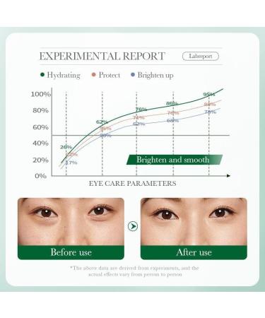  JPSDOWS Repairing Eye Cream Olive Oil Shine Eye Cream to Reduce Puffiness | 20g Revitalizing Eye Moisturizer Targets Crow's Feet Firmness Puffiness and - Buy Online on GoSupps.com