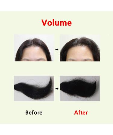 SCALP SSAG SERUM 140ml - Premium Scalp Treatment for Healthy Hair | Free International Shipping - Buy Online on GoSupps.com