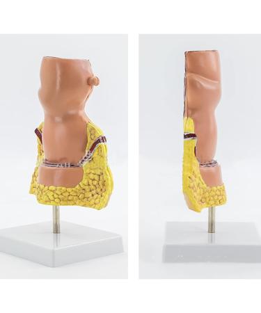 Human Anorectal Pathology Model Hemorrhoid Lesion Model Proctology Hemorrhoid Anal Fistula Lesion Model for Medical Teaching/Education Supplies - Buy Online on GoSupps.com