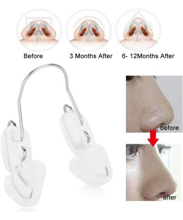 Nose Up Shaping Lifting Redressage Clip Pont Enhancer Shaper Correcteur Transparent Booster Pont Nez - Buy Online on GoSupps.com
