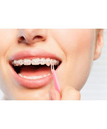 SmileSupplies Dental Teeth Rubber Band Placers for Braces - Disposable Orthodontic Elastic Multi-Color (20 Pcs) - International Shipping Available - Buy Online on GoSupps.com