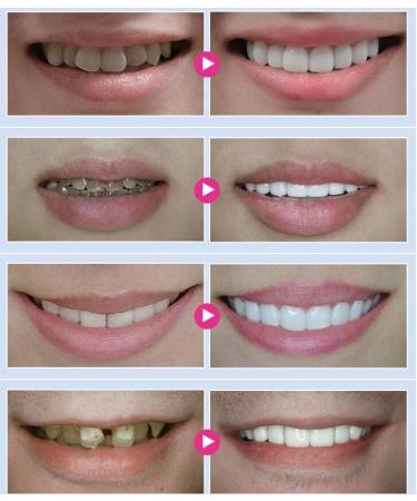 2pcs SowSmile Teeth Tooth Whitening Essence Oral Hygiene Cleansing Remove Plaque Stains Fresh Breath Dentistry Bleaching Products - Buy Online on GoSupps.com