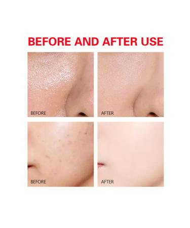 DISAAR BEAUTY Pomegranate Vitamin E Facial Serum Anti-Aging Essence Revitalizing Face Skin Repair Refines Pores 30ml / 1.01fl.oz - Buy Online on GoSupps.com