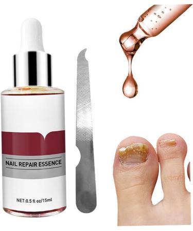 1PC Nail Treatment Nail Renewal Solution Toenails & Fingernails Nail Repairs Essential Oil Protects Toenail Fungus Treatment From Discoloration Brittle And Cracked Nail(12ML) - Buy Online on GoSupps.com