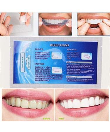 Advanced Teeth Whitening Strips Gentle for Sensitive Teeth Professional Effect to Remove Stains Teeth Whitening for Oral Care 14 Treatment 28 Strips (14 Pairs) - Buy Online on GoSupps.com