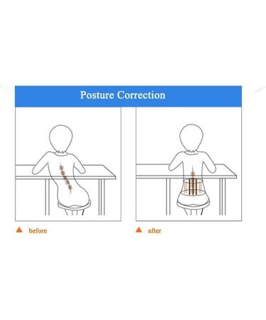1Pcs Posture Corrector Back Support Comfortable Back and Shoulder Brace for Men Women - Medical Device to Improve Bad Posture (Size : Large) Made in China - Buy Online on GoSupps.com