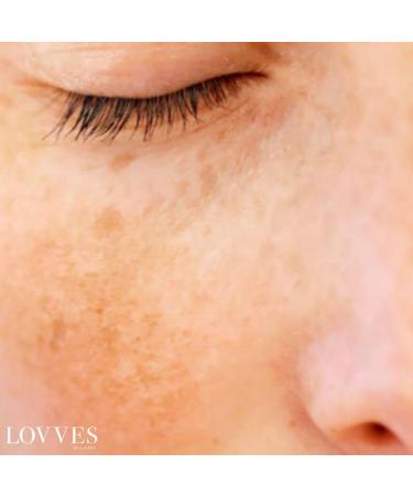 LOVVES Antiblemish facial serum Brightening High Natural Cosmetics Depigmenting Reduces Hyperchromia of the Skin Prevents the Formation of New Pimples Smoother Skin 30 ml - Buy Online on GoSupps.com