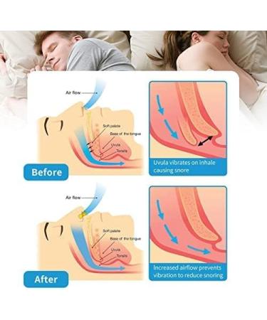 Silicone Magnetic Snore Stopper - Blue (4pcs) | Anti Snoring Nose Clip for Quieter Sleep - Buy Online on GoSupps.com