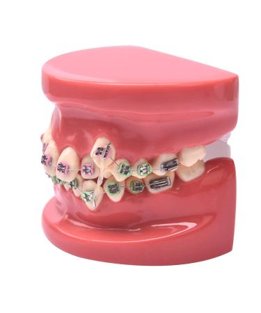 Dental Elastics Bands | Monkey Force Rubber Bands | Orthodontic Supply (3/8) - 10 Bags, 3.5 oz - Buy Online on GoSupps.com