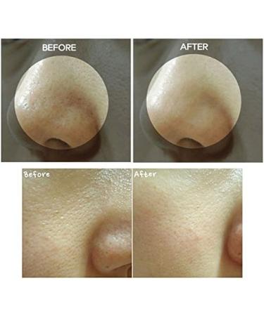 Vegan Beauty Blackhead & Whitehead Remover - BONAJOUR Sebum Cleansing Gel | Deep Pore Cleanse with Natural Ingredients - 3.5 fl. oz - International Shipping - Buy Online on GoSupps.com